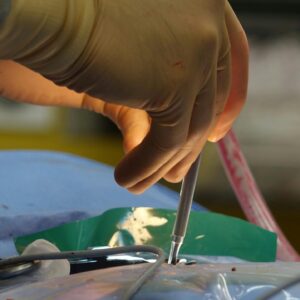 Detailed view of a surgical operation, highlighting precision medical tools in use.